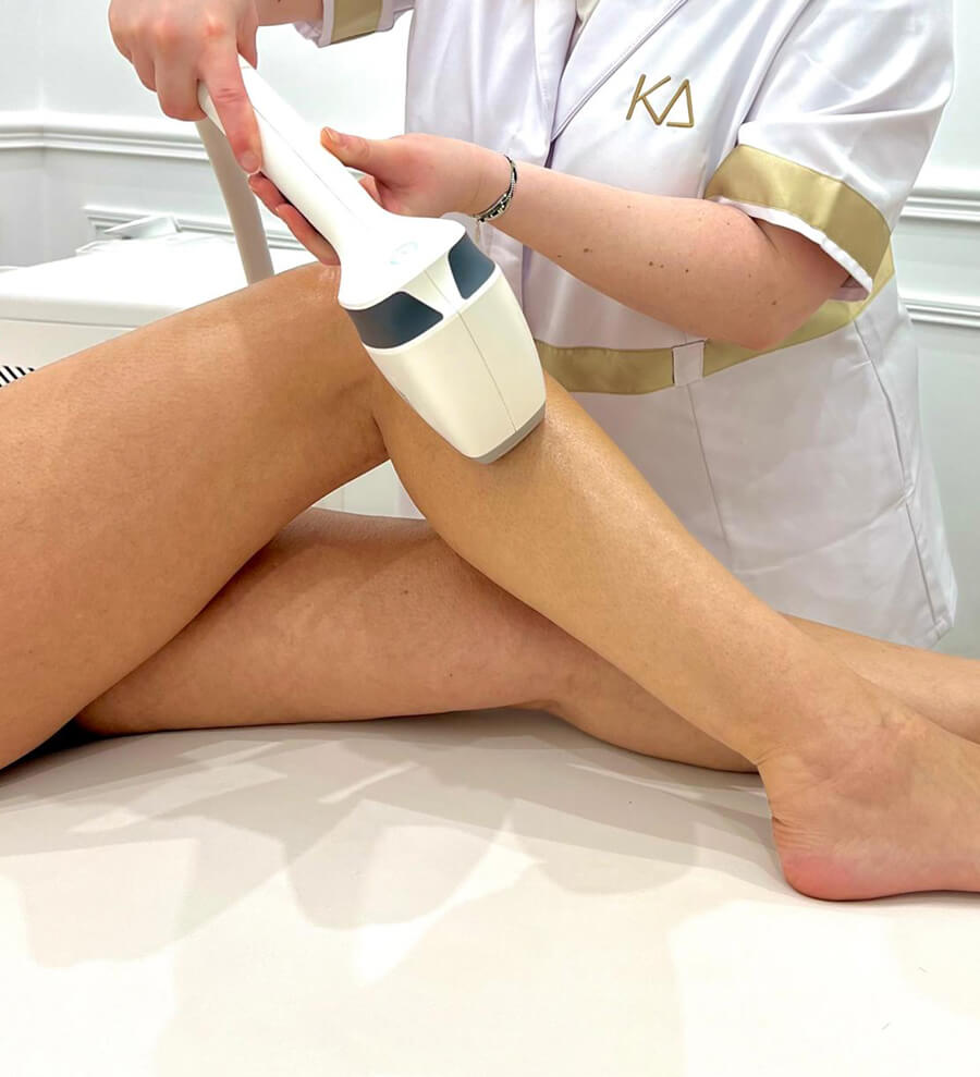 Séance d'épilation avec des résultats visibles dès la 1e séance