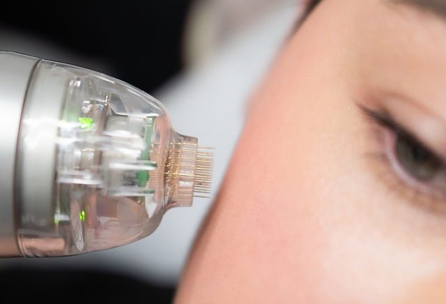 Microneedling Collagen